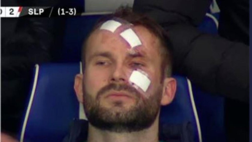 Kolar was left with cuts to his face after being kicked by Roofe. Screenshot/MovistarLigadeCampeones