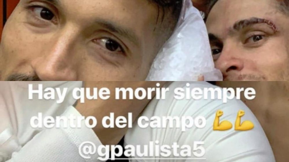 Gabriel mostró las grapas en la ceja. Instagram/Garay