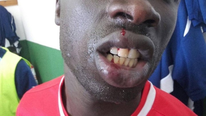 El Alma de África retira a su equipo tras la agresión a un jugador