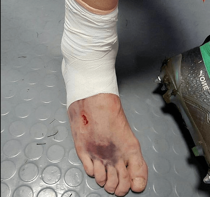 Kutepov jugó con una herida en el pie más de 100 minutos