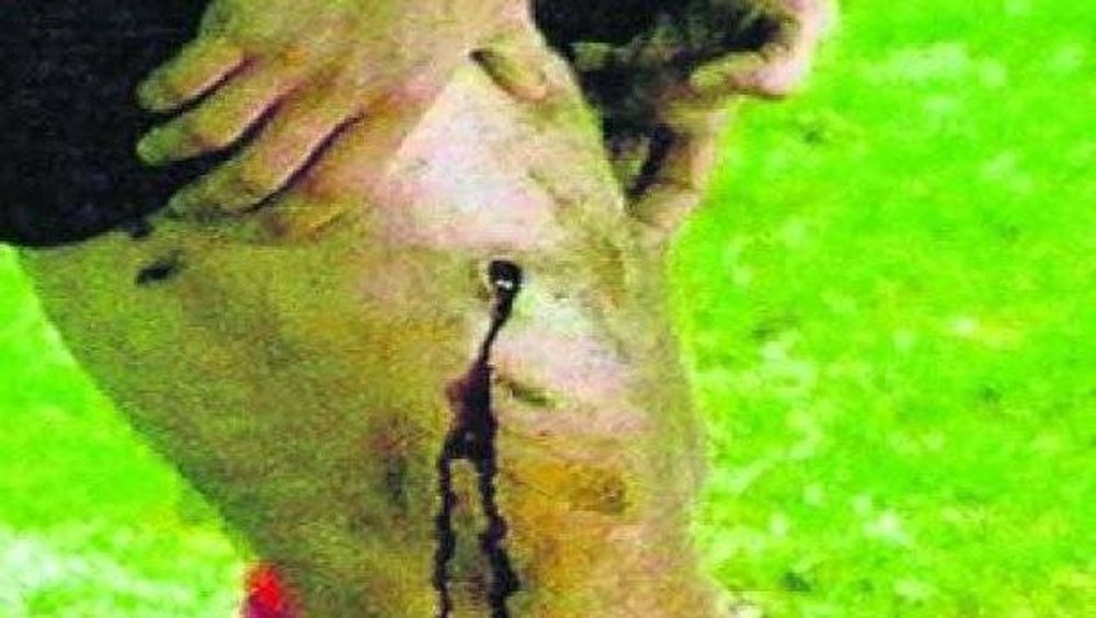 Guerrero sufrió un pisotón de Simeone que le perforó el muslo. EFE/Archivo