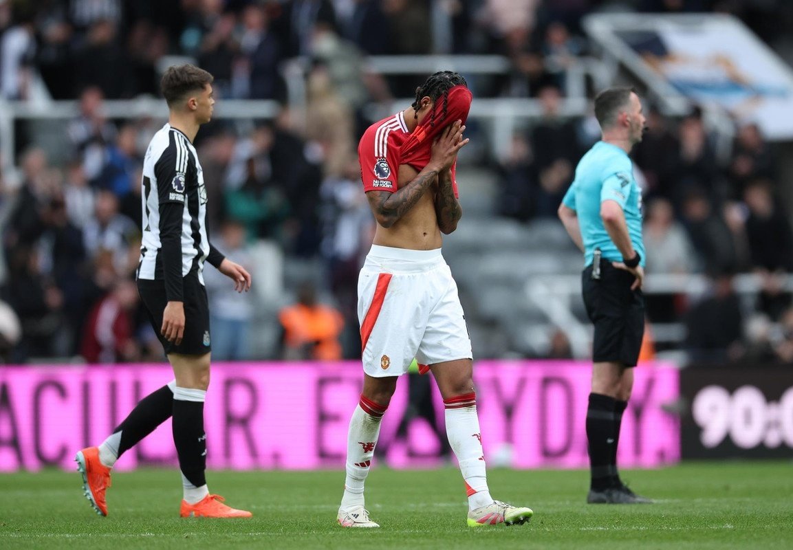 Leny Yoro injury not thought to be serious, says Amorim