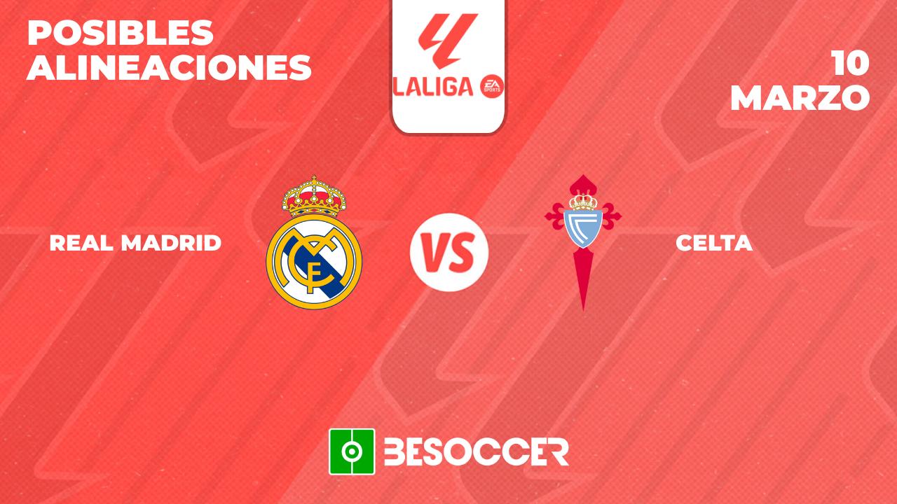 Posibles Alineaciones Del Real Madrid Vs Celta