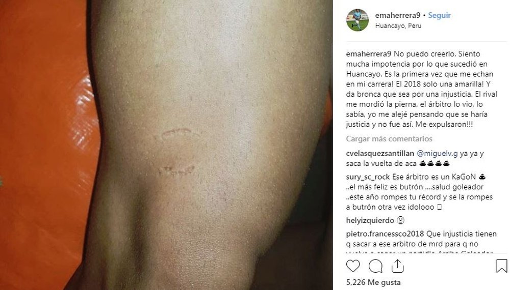 Emanuel Herrera, indignado: le mordieron y le expulsaron. Instagram/emaherrera9
