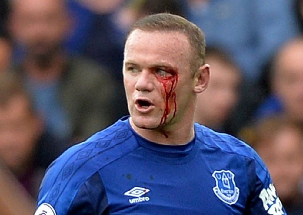 Rooney a été blessé à l'oeil gauche lors du match de Premier League contre Bournemouth. Twitter