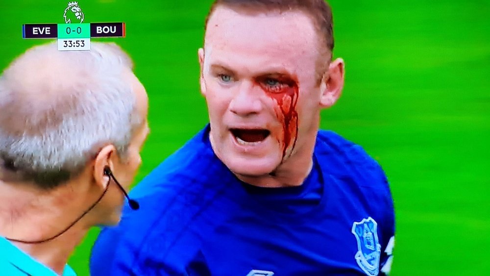 Rooney was caught in the face against Bournemouth. Twitter