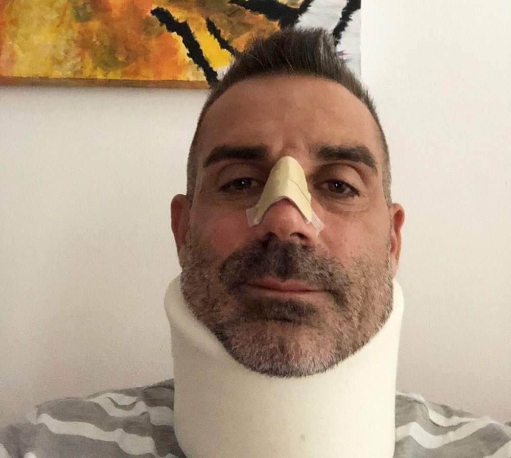 Sorrentino, avec une minerve et une bandage sur le nez. Twitter