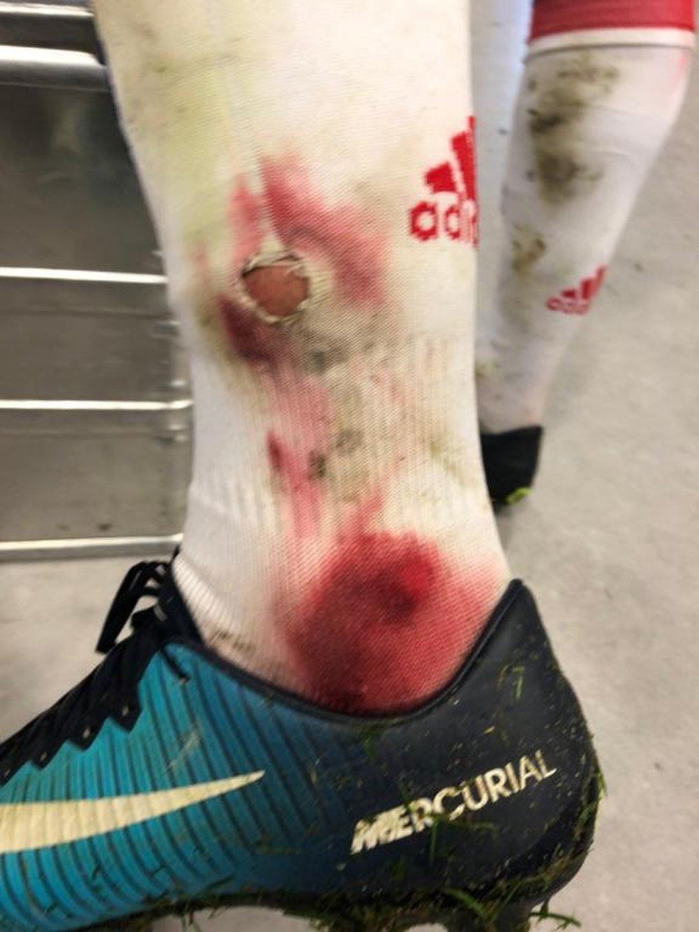 Fekir was left with a heavily bloodied ankle. Twitter