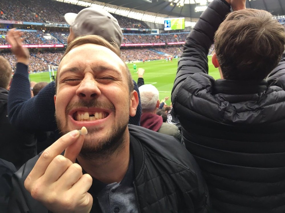 Un fan del United se dejó un diente al celebrar el gol de Rashford ante el City. Twitter @JontyJonty500