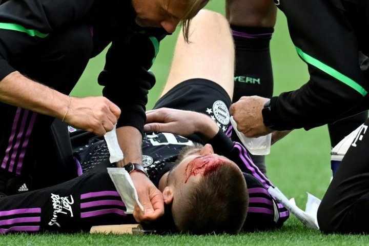 Eric Dier had to be treated after a blow to the head. AFP