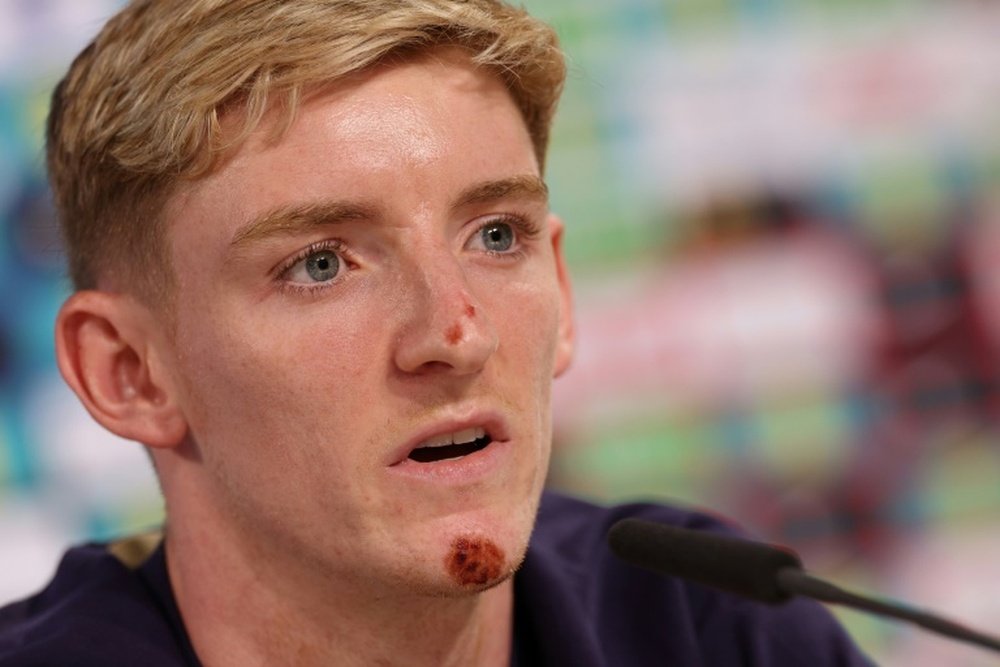 Gordon came off his bike during a recovery session at their Euro 2024 training camp. AFP