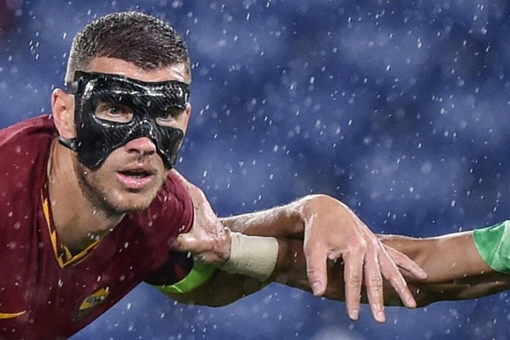 Masked man Dzeko 'can't see very well' but still scores. AFP