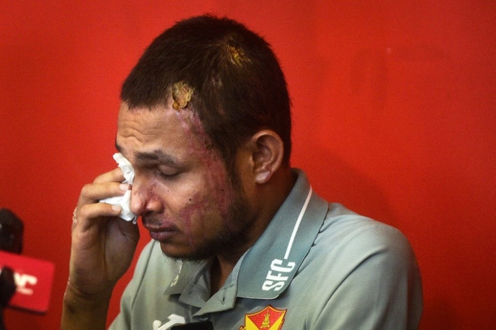 Faisal Halim was severely injured in an acid attack last month. AFP