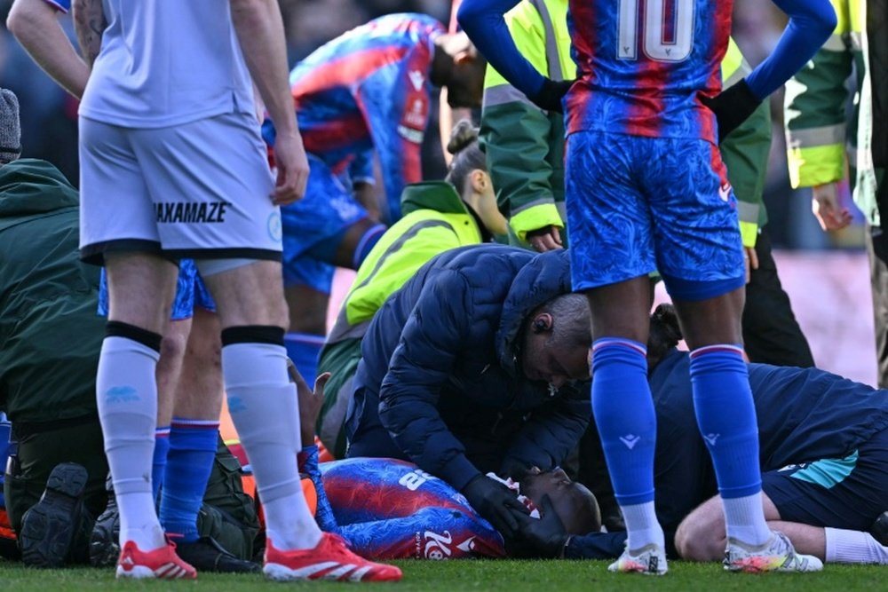 Jean-Philippe Mateta needed 25 stitches in a ear injury. AFP