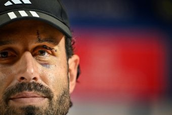 L'entraîneur de l'OL Fabio Grosso, sérieusement blessé au visage dimanche lors du caillassage du car des Lyonnais à Marseille, a réclamé vendredi 