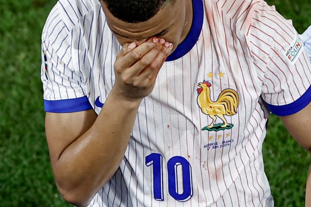 La blessure de Mbappé, gros nuage dans le ciel bleu. AFP