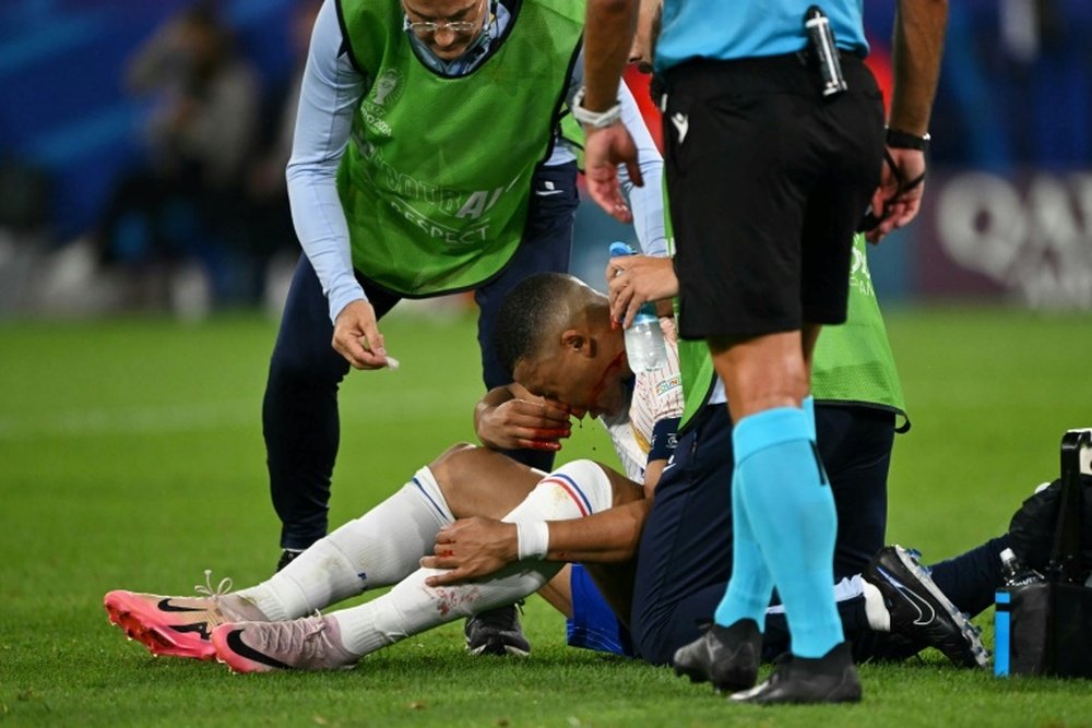 Le capitaine des Bleus Kylian Mbappé le nez en sang. AFP