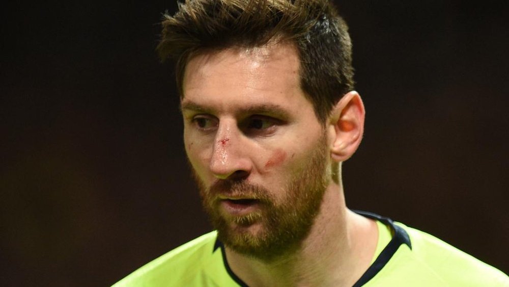 Messi a pris un coup de Smalling au visage. Goal